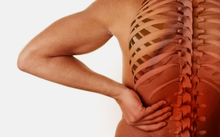 Lumbararen osteokondrosiaren kausak
