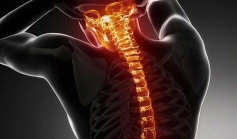 Bizkarrezurraren osteokondrosia