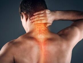 Osteokondrosis cervikoaren lehen seinaleak eta sintomak